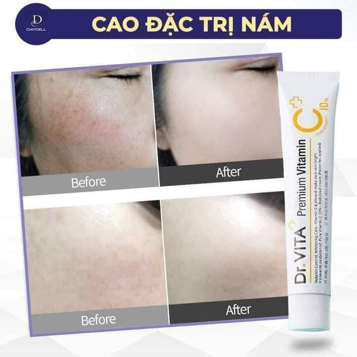 CAO ĐẶC TRỊ NÁM DR.VITA C