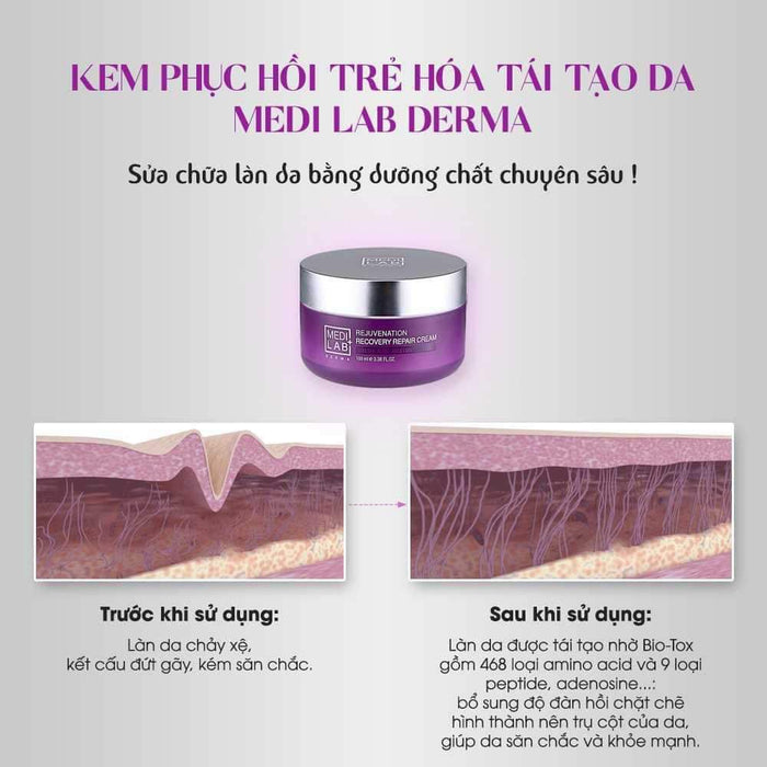 Medilab Rejunevation Recovery Repair Cream - Kem Phục Hồi Trẻ Hoá Tái Tạo Da Biotox Tím