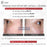 Ruee Red Peel Whitening Serum - Serum Lột Trắng Sáng Da Ruee